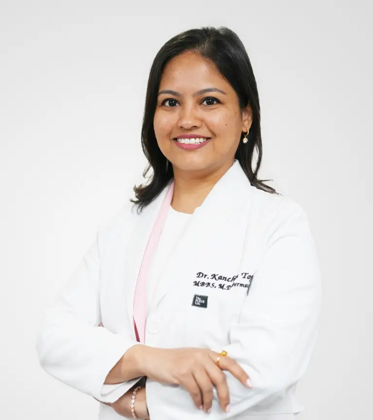 Dr. Kanchan S | Dermatologist | Visiting Consultant