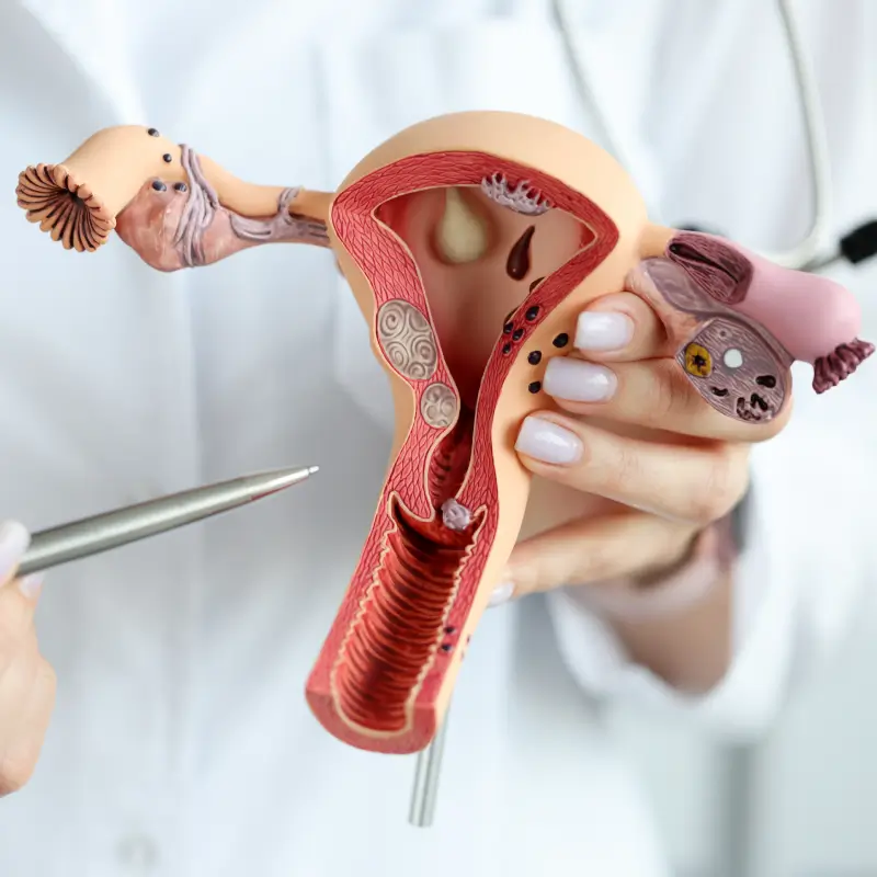 10 Home Remedies for Vaginal Yeast Infections