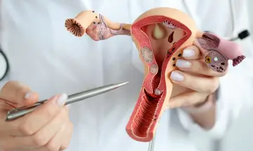 10 Home Remedies for Vaginal Yeast Infections