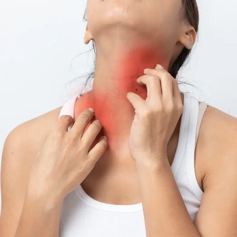 What Is an Allergy?