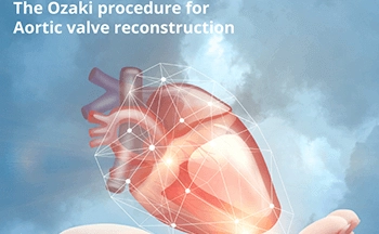 Aortic valve Surgery