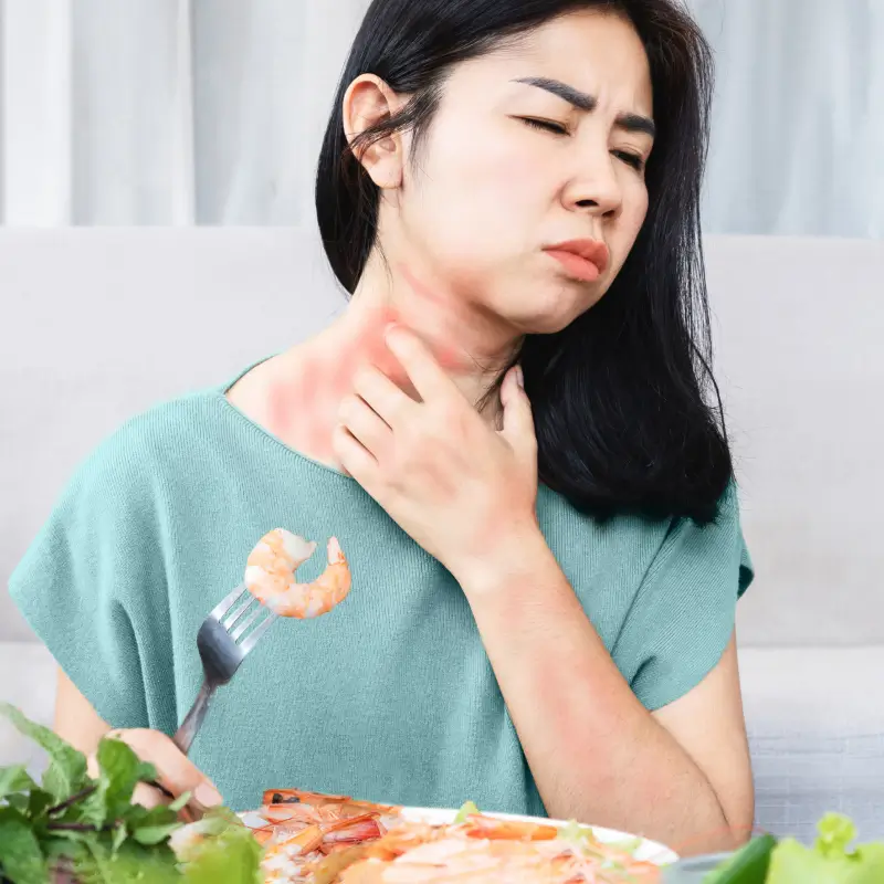 Food Allergies: Symptoms and Treatment