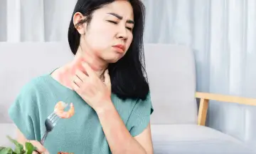 Food Allergies: Symptoms and Treatment