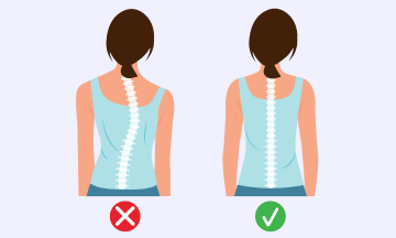 10 Scoliosis Exercises and Stretches