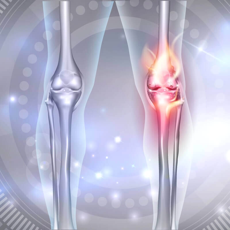 Meniscal Transplant Surgery