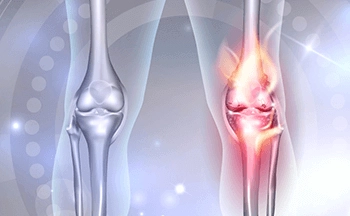 Meniscal Transplant Surgery