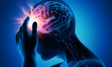 Brain Stroke causes 