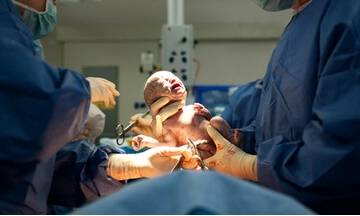 caesarean section surgery in banglore