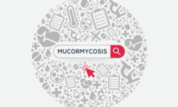 mucormycosis treatment in india