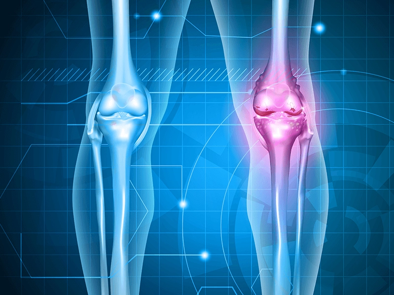 Knee Replacement Surgeons in Bangalore