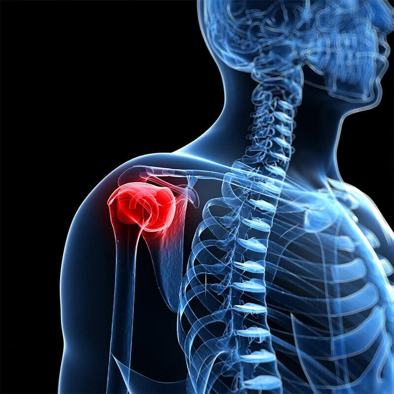 arthroscopic rotator cuff repair surgeon in bangalore