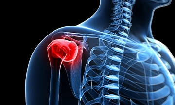 arthroscopic rotator cuff repair surgeon in bangalore