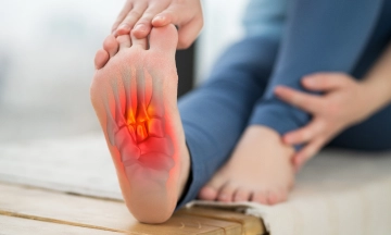 Plantar Fasciitis causes