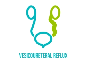 vesicoscopic ureteric reimplantation in bangalore