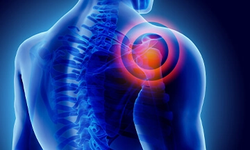 best rotator cuff repair surgeons in bangalore